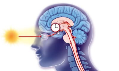 Cluster Headache, Migraine Linked to Circadian Arrangement