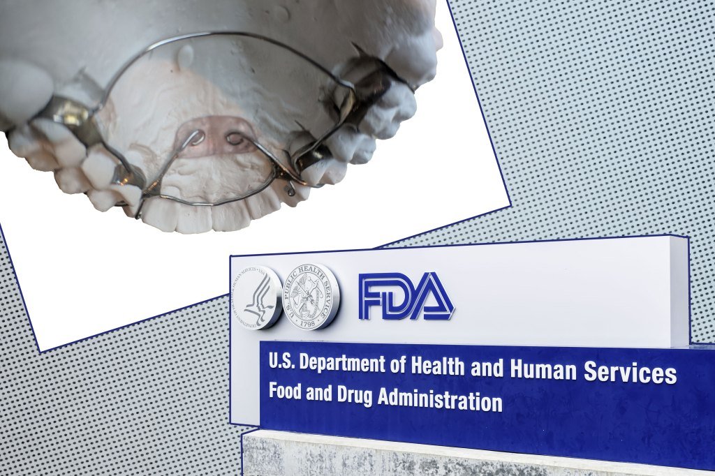 FDA Evaluates ‘Security Concerns’ Over Dental Gadgets Featured in KHN-CBS Investigation