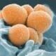 Strep A infections amongst early life surged in France across 2022, after nearly two-years of COVID-linked low case numbers