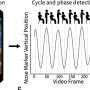 Smartphone movies of the sit down-to-stand take a look at predict osteoarthritis and health outcomes in a nationwide gaze