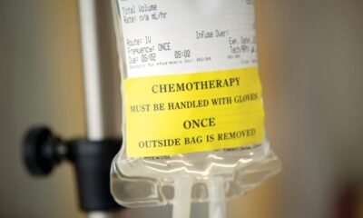 Dwelling most cancers treatment faces challenges put up-pandemic