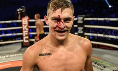 22-one year-weak Kai Stewart built varied this skill that of ‘I selected bare-knuckle’ nevertheless most other folks in BKFC ‘right here’s their final chance’
