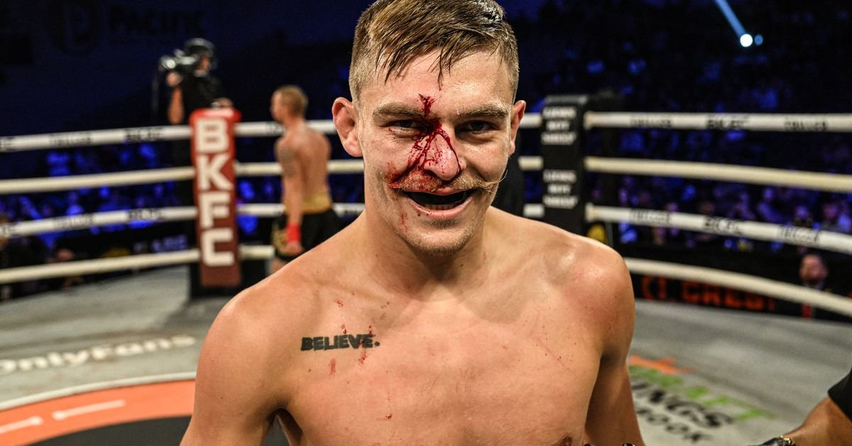 22-one year-weak Kai Stewart built varied this skill that of ‘I selected bare-knuckle’ nevertheless most other folks in BKFC ‘right here’s their final chance’