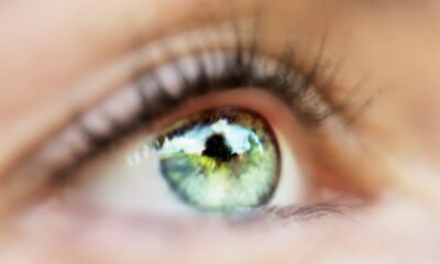 Bayer initiates section III survey to overview aflibercept 8 mg in retinal vein occlusion