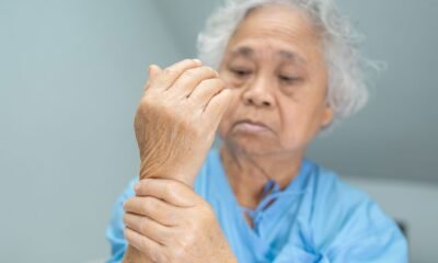 BlueRock Therapeutics Announces Completion of Enrollment of Share 1 Trial in Sufferers with Parkinson’s Disease