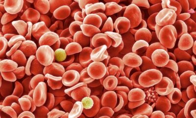 Two colossal Xarelto™ analysis lend a hand effectiveness of twin pathway inhibition in sufferers with coronary artery disease and/or peripheral artery disease