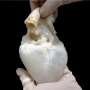 Lab-grown ‘ghost hearts’ mix a cleaned-out pig heart with a affected person’s possess stem cells